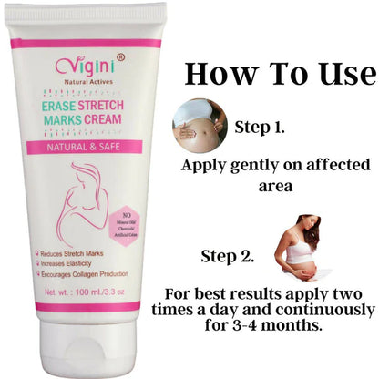 Vigini Natural Actives Stretch Marks Scars Removal Oil Cream - 100 gm