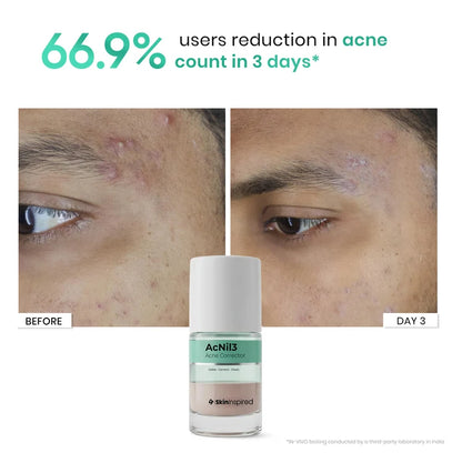 AcNil3 Acne Spot Corrector (12ml)