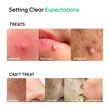 AcNil3 Acne Spot Corrector (12ml)