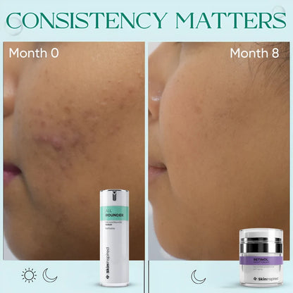 All Rounder - 10% Niacinamide Face Serum