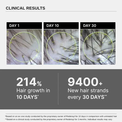 Bare Anatomy Advanced Hair Growth Serum for Scalp 3% Redensyl, 4% Anagain, 3% Baicapil - 20 ml - Pack of 1