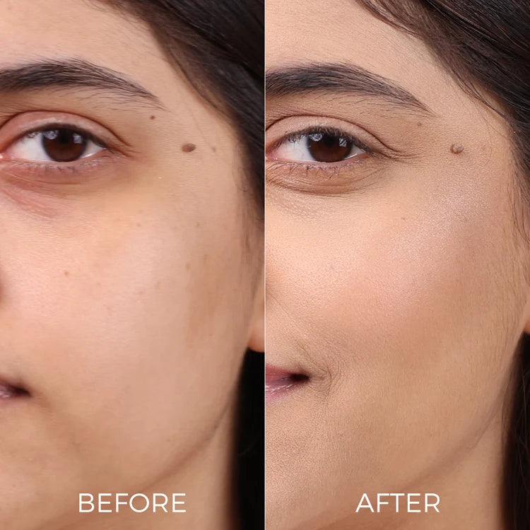 Mini Niacinamide Face Serum for Smooth, Glowing Skin (5ml)