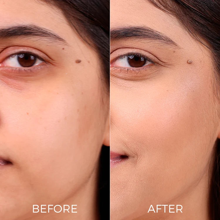 2% Salicylic Acid Face Serum for Acne-Prone Skin