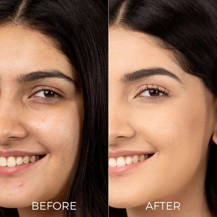 10% Vitamin C Face Serum for Bright, Glowing Skin