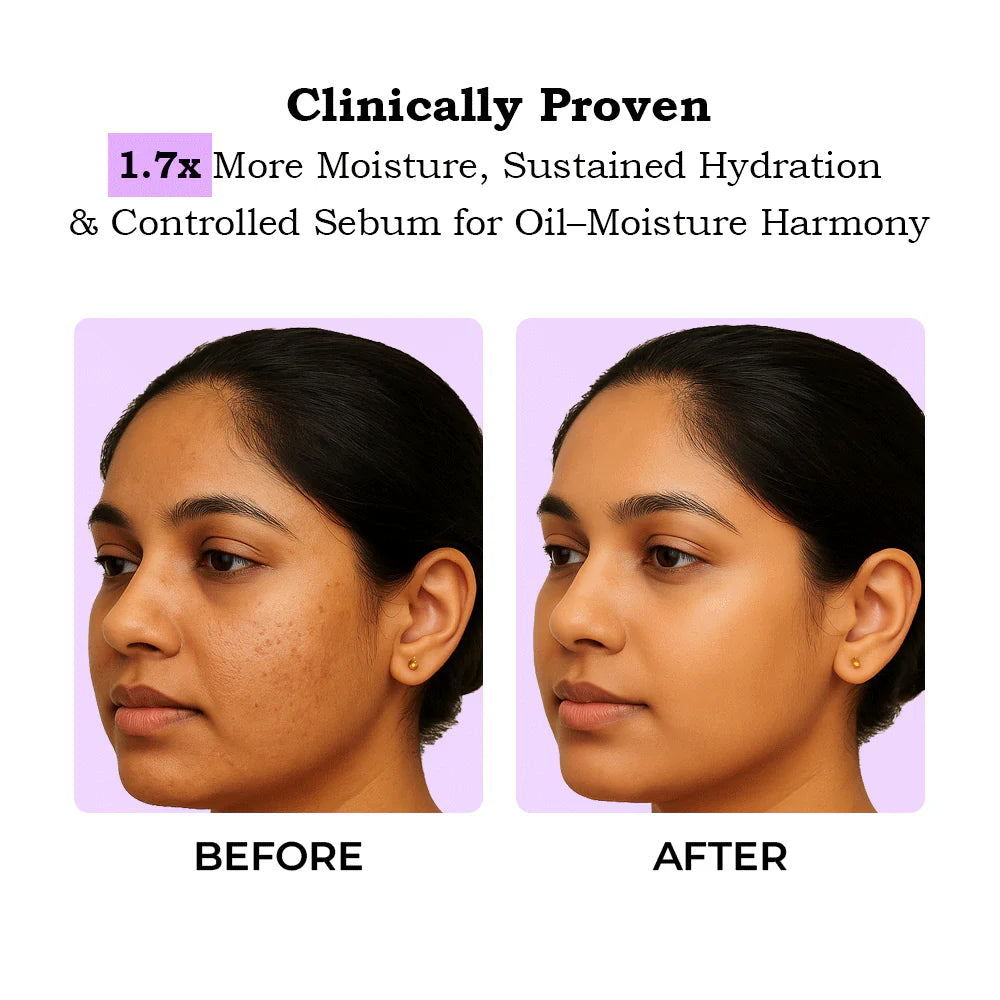 TYC Ceramide Moisturizer - 50 ml