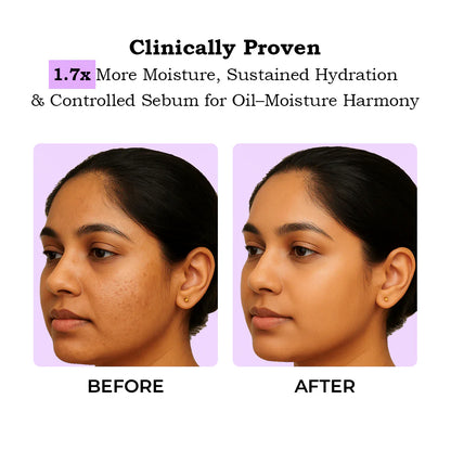 TYC Ceramide Moisturizer - 50 ml