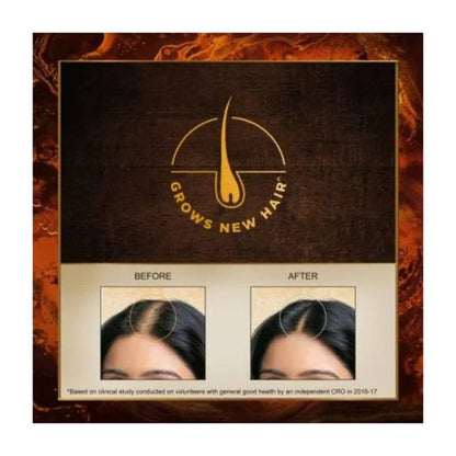 Indulekha Bhringa Hair Oil 100 ml