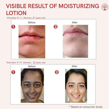 Ivory Natural Moisturizing Lotion Nourishes, Hydrates, And Revitalizes Dry Skin For Radiant Glow - 200 ml