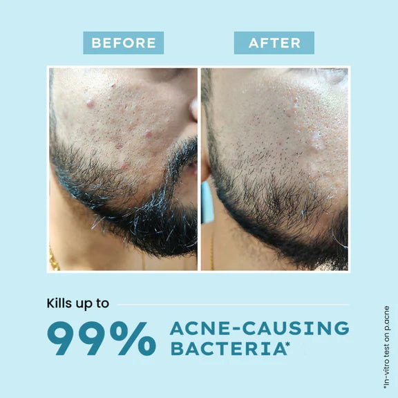 Hyphen By Kriti Sanon Clarifying Acne Cleanser With 2% Salicylic Acid, Anti-Acne Face Wash For Oil Control - 100 ml