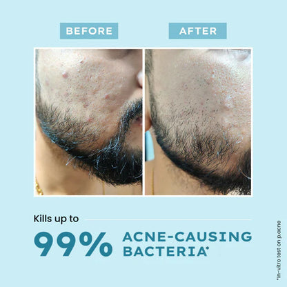 Hyphen By Kriti Sanon Clarifying Acne Cleanser With 2% Salicylic Acid, Anti-Acne Face Wash For Oil Control - 100 ml