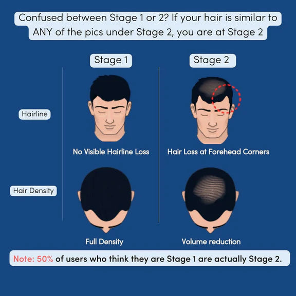 Man Matters Stage 1 Hairloss Kit for Scalp Health - Biotin Hair Gummies & DHT blocking Shampoo - kit