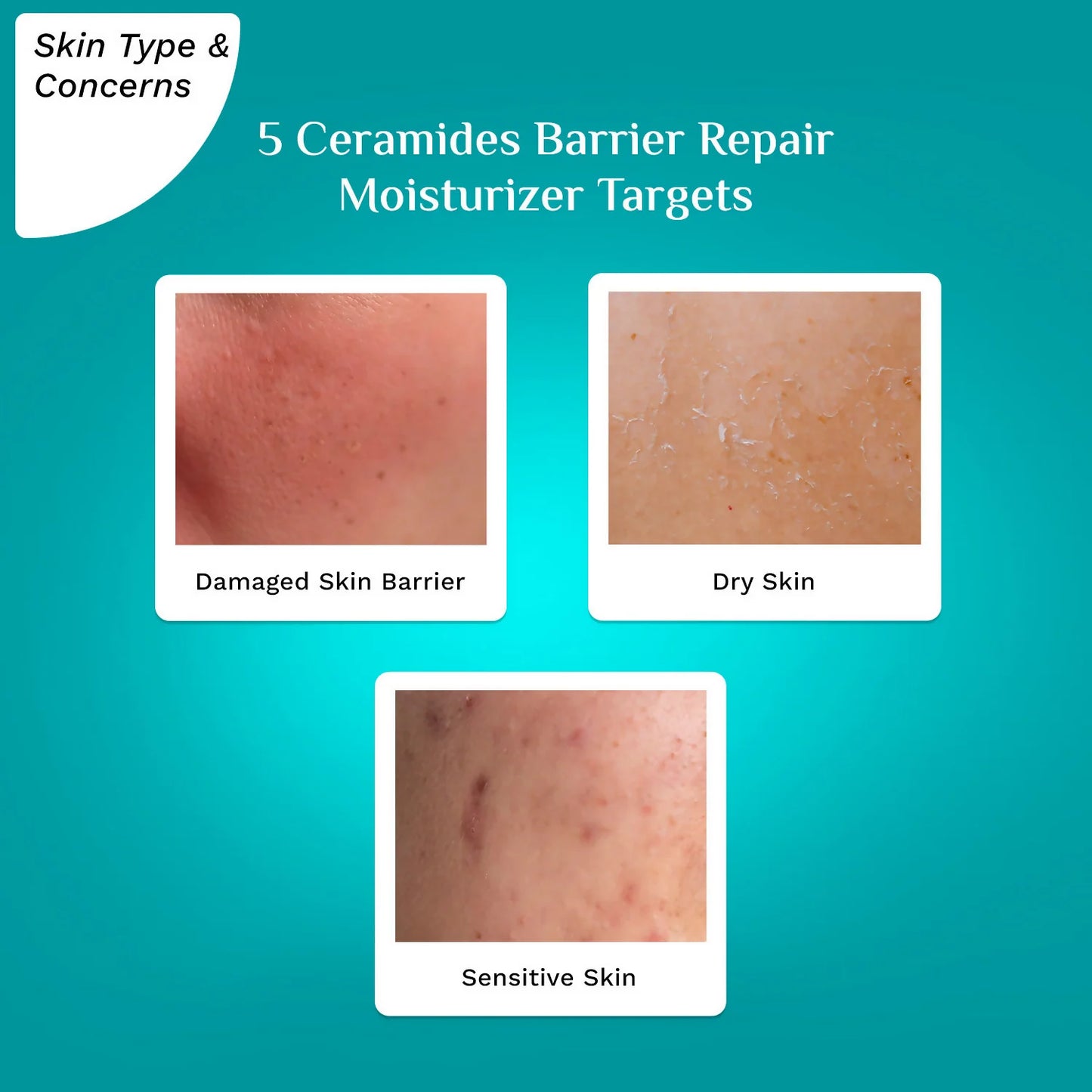 Pilgrim 5 Ceramides Barrier Repair Moisturizer - 100 gm
