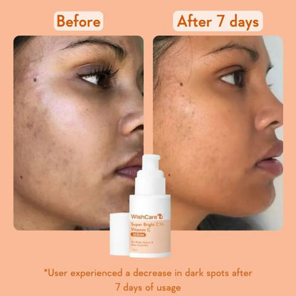 Wishcare Super Bright C16 Vitamin C Face Serum - 30 ml
