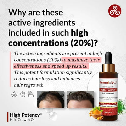 Derma Global High Potency Hair Growth Oil - 60 ml