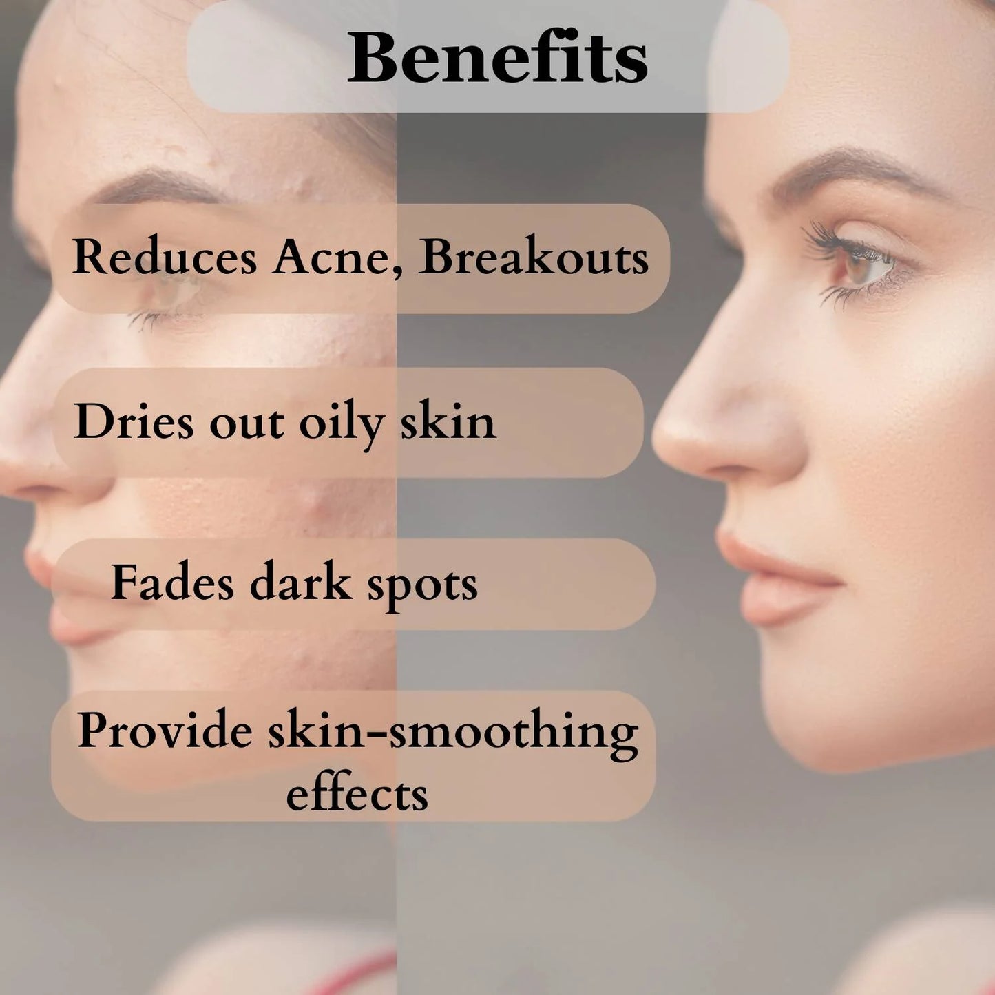 Dermistry Mattifying Moisturizer & Anti Acne Foaming Face Wash - combo