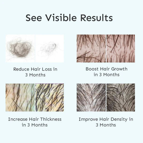Arata Intensive Hair Growth Serum - 30 ml
