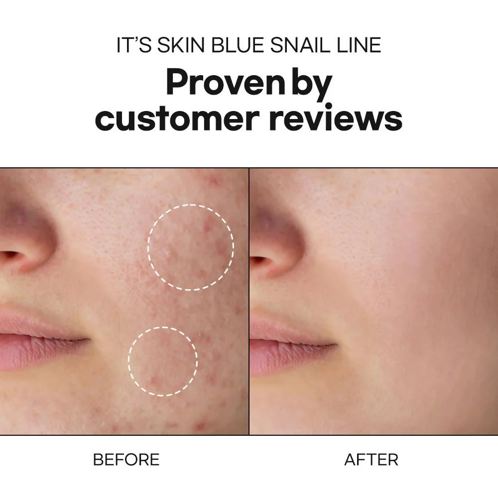 It's Skin Blue Snail Moisturizer - 50 ml