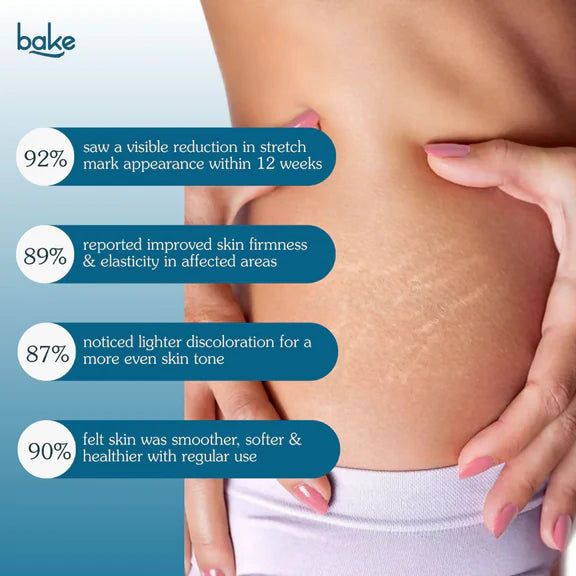 Bake StriErase™ Stretch Marks Removal Roll-On Serum - 50 ml