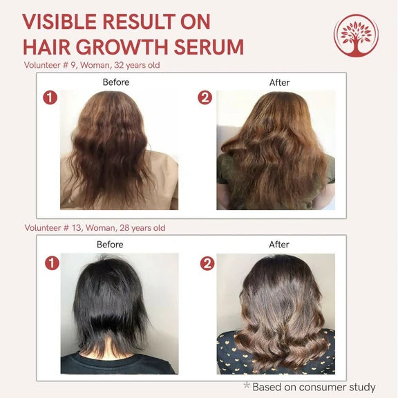 Ivory Natural Serum For Growth Of Hair For New Hair Roots & Encouraging Growth Of Hair - 55 ml