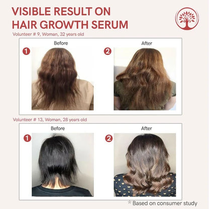 Ivory Natural Serum For Growth Of Hair For New Hair Roots & Encouraging Growth Of Hair - 55 ml