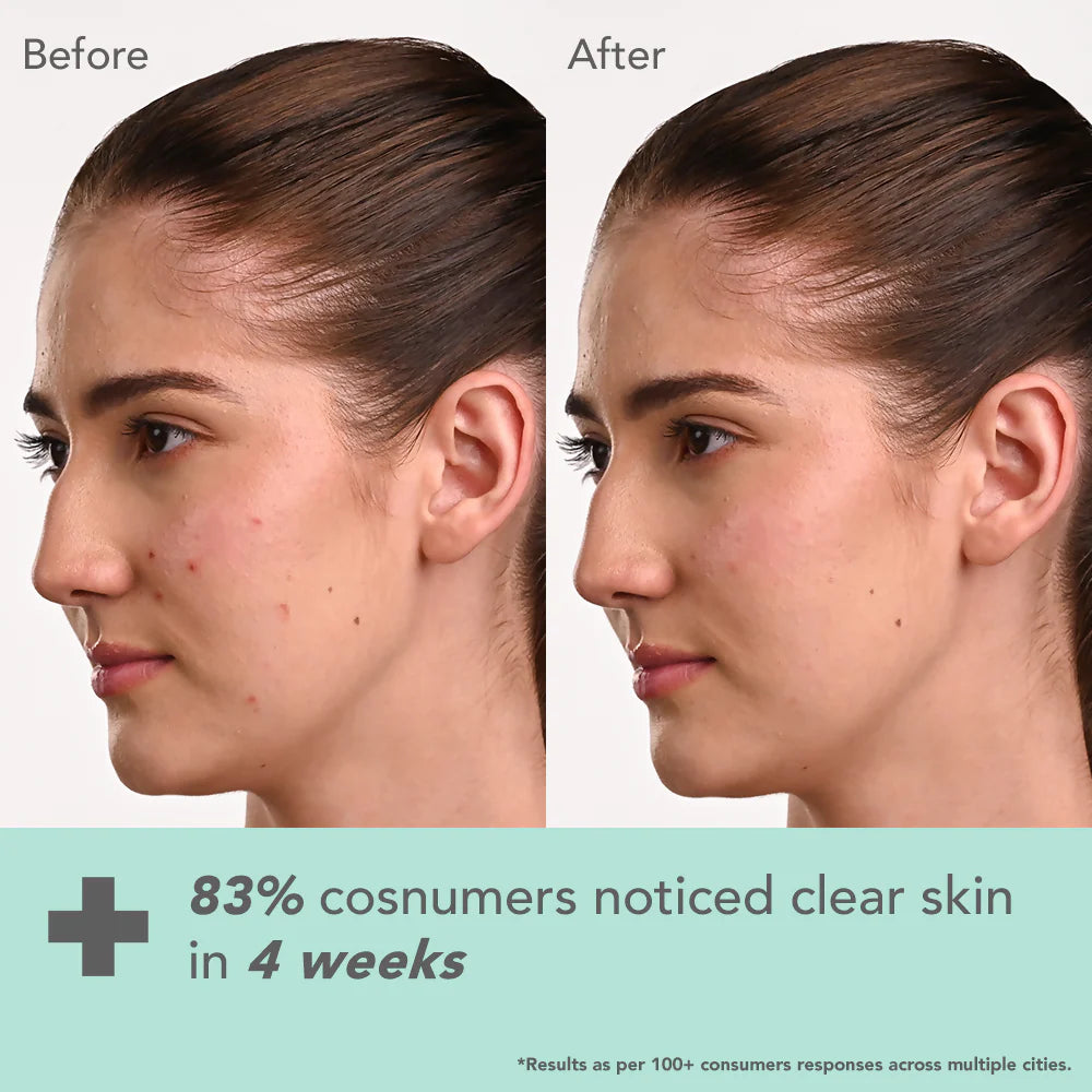 Lotus DermaBotanics Kojic acid + Multi berry Ampoule Crème - 50 gm