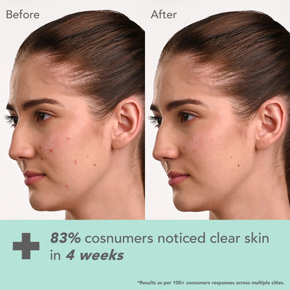 Lotus DermaBotanics Kojic acid + Multi berry Ampoule Crème - 50 gm