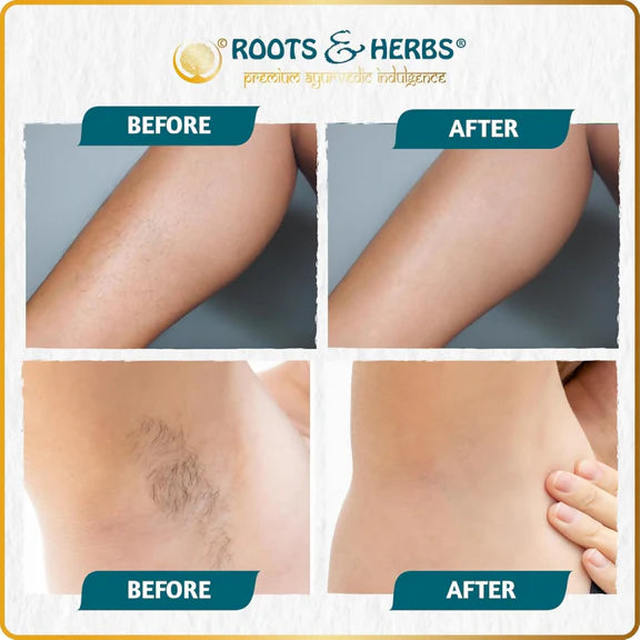 Roots and Herbs Neem and Fennel Depilatory Ubtan for Hair Removal - 70 gm