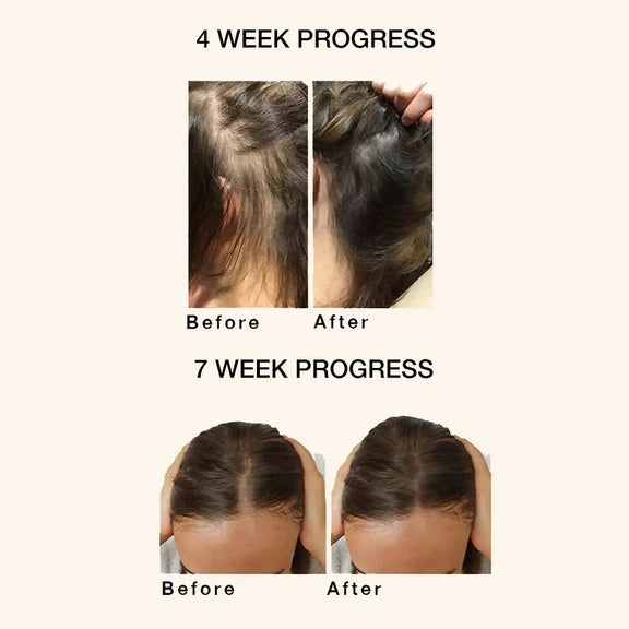 Skog Super Hair Repair - 30 ml