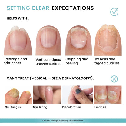 Nail Serum | For Strengthening, Nourishing & Natural Shine