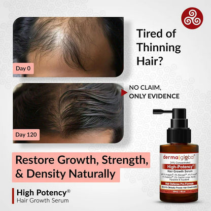 Derma Global High Potency Hair Growth Serum - 30 ml - Pack of 1