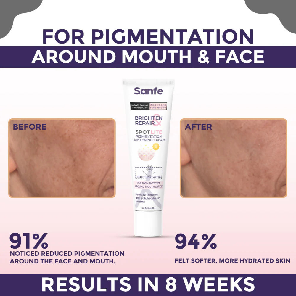 Sanfe Brighten & Repair Spotlite Pigmentation Lightening Cream - 20 gm