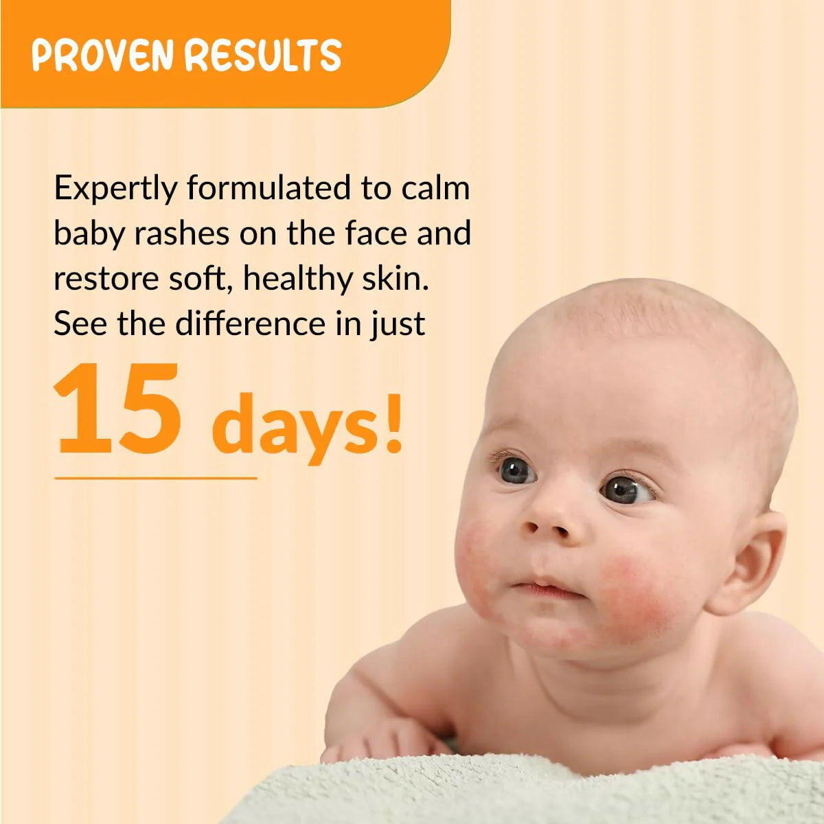 Fixderma Hoopoe Baby Anti-Rash Face Cream - 50 gm