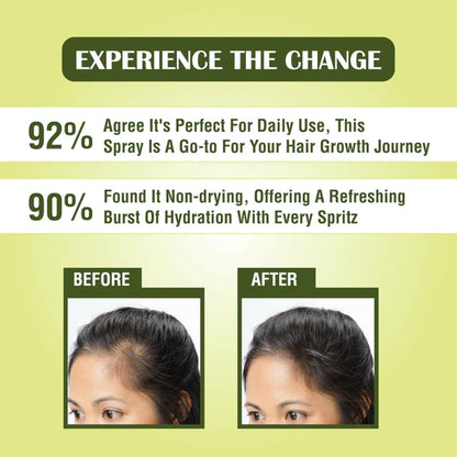 Myherb Rosemary Water Hair Spray For Regrowth, Helps Reduce Hairfall, Strengthens Hair - 200 ml