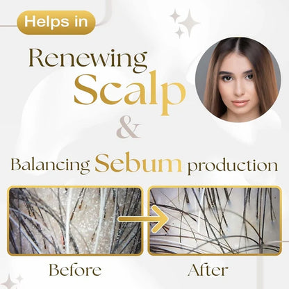 Siya Ayurveda Scalp Exfoliating Serum - 50 ml