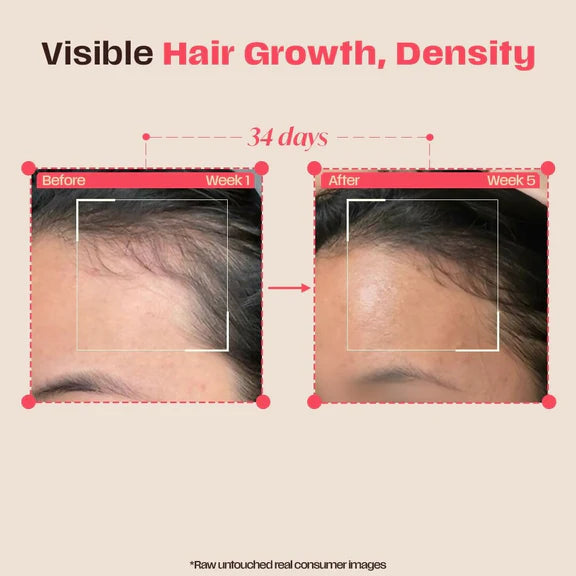 Days Ahead Leave-in Hair Growth Ampoule Serum (Roll on) - 25 ml