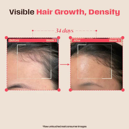 Days Ahead Leave-in Hair Growth Ampoule Serum (Roll on) - 25 ml