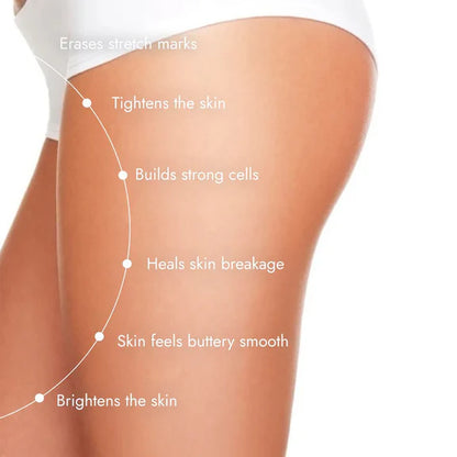 Cos-IQ Stretch Marks Removal Roll-On Serum with Striover - 40 ml