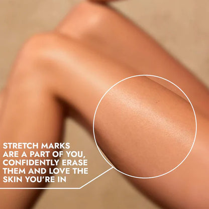 Cos-IQ Stretch Marks Removal Roll-On Serum with Striover - 40 ml