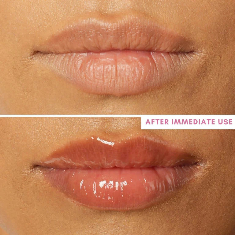 The Skin Diet Company Lip Barrier Oil Clear Gloss with Peptides Hydrates, For Dry & Pigmented Lips - 5 ml