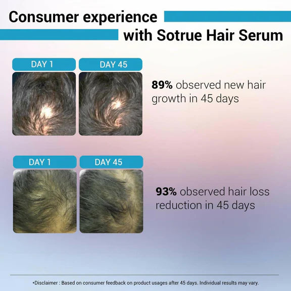 Sotrue Hair Growth Serum With Redensyl 3%, Procapil 3%, Anagain 4% and Baicapil 2% Hair Growth Actives - 30 ml