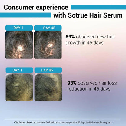 Sotrue Hair Growth Serum With Redensyl 3%, Procapil 3%, Anagain 4% and Baicapil 2% Hair Growth Actives - 30 ml