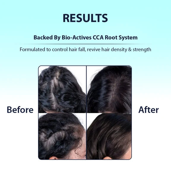 Dermistry Caffeine Collagen Protein Anti-Hair Fall Control Mask & Serum - combo