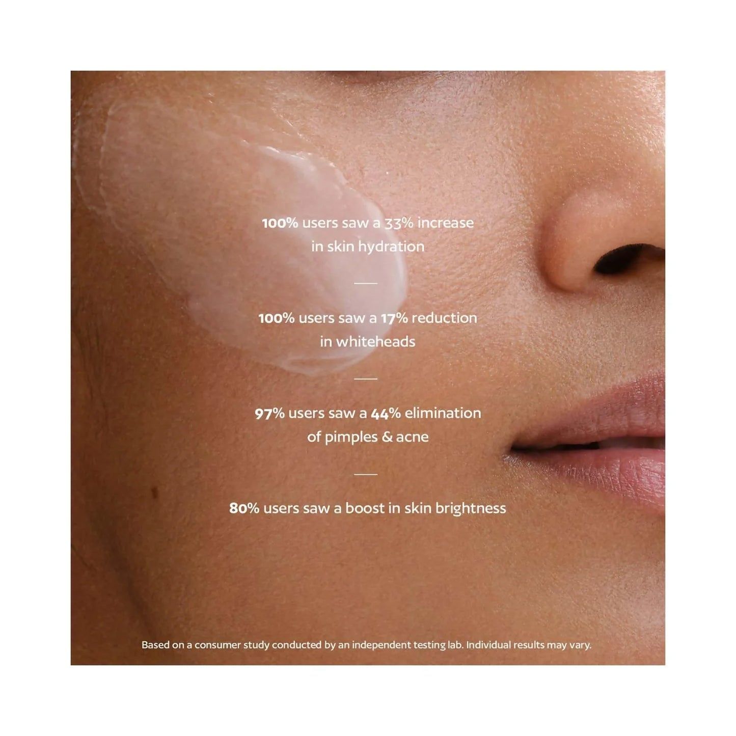 Akind On Cloud Nine Lightweight Moisturiser - 15 gm