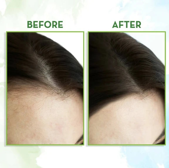 Mamaearth Rosemary Hair Growth Oil with Rosemary & Methi Dan