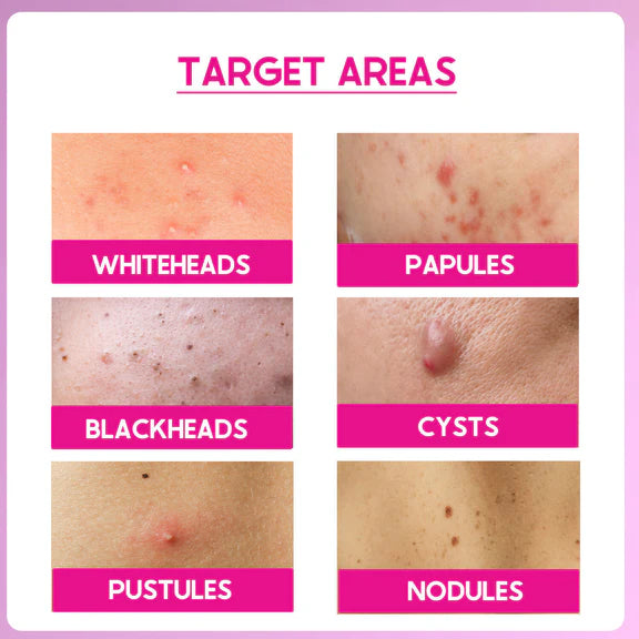 Cos-IQ ABP 33% Strong Exfoliating Peel - 30 ml