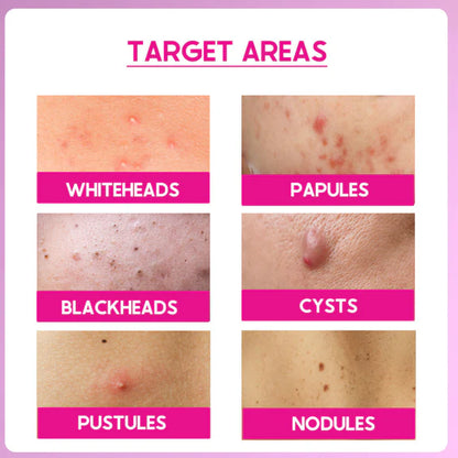 Cos-IQ ABP 33% Strong Exfoliating Peel - 30 ml