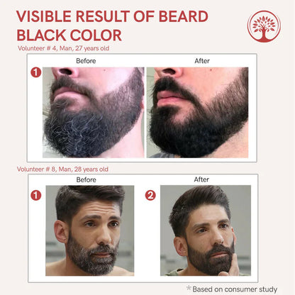 Ivory Natural Beard Black Color Organic - Instant Natural Plant Based Beard Color Powder - 30 gm