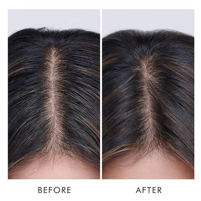 Moroccanoil Oily Scalp Treatment For Oily, Imbalanced Scalps - 45 ml