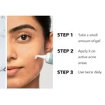 Novology Acne Spot Corrector Gel With 0.1% Thymol + Terpineol - 30 gm