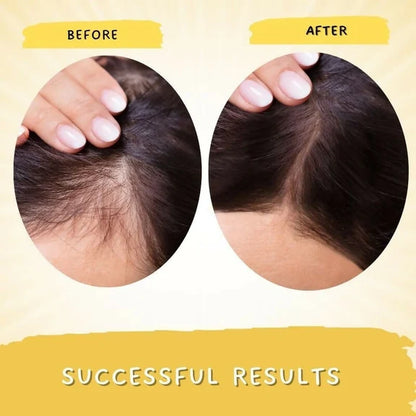 Mystiq Living Rosemary Hair Growth Serum - 30 ml